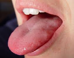  Tongue180107ajn8